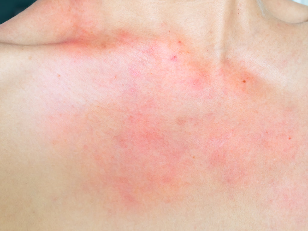 Can Dancewear Cause Skin Irritation?